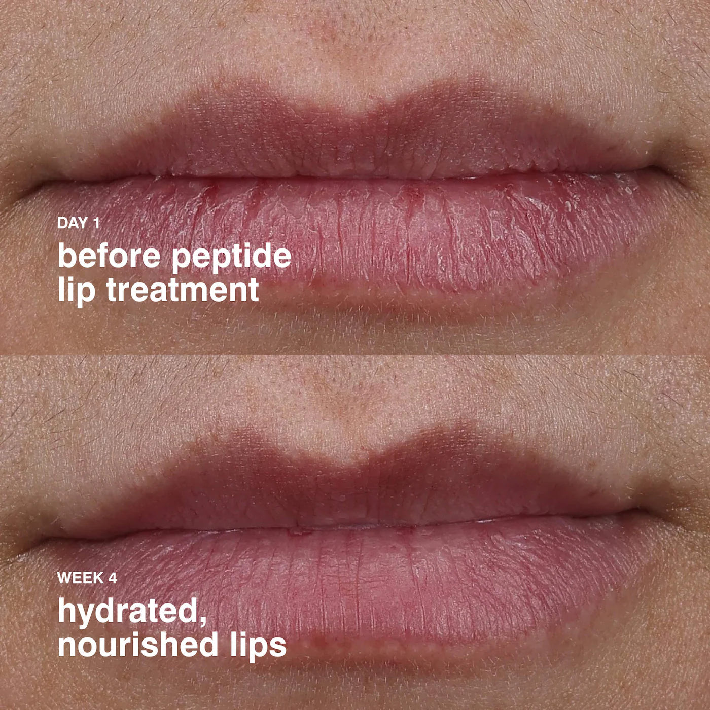 Rhode Peptide Lip Treatment